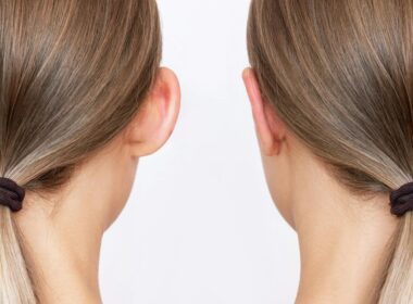 Jak leczyć ucho kalafiorowe